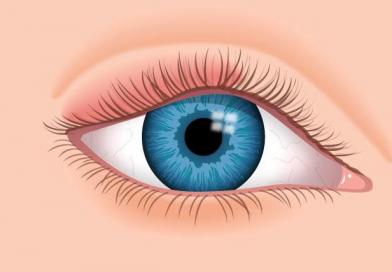 Las causas de la apariencia y los métodos para tratar la inflamación de los ojos.