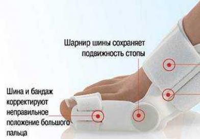 Causas de los huesos de la pierna, síntomas y tratamiento.